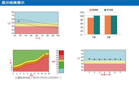 骨密度檢測儀廠家